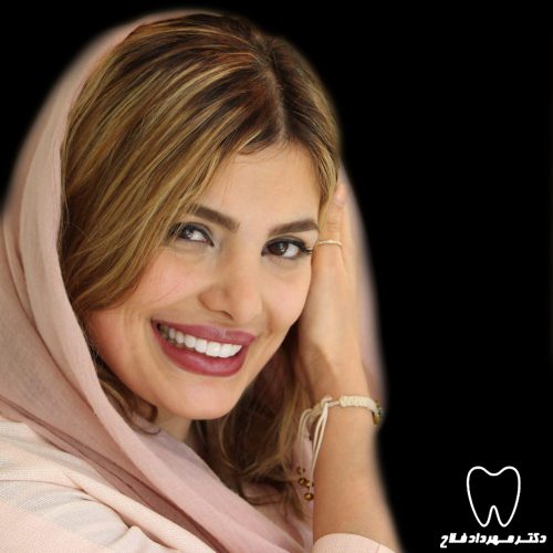 زیبایی دندان زیبایی دندان