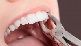 خطرات و عوارض کشیدن دندان