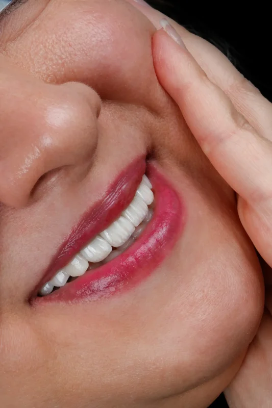 درمان ترکیبی ایمپلنت و لمینت دندان؛ راهکاری نوین برای لبخندی زیبا و ماندگار نتیجه نهایی درمان ترکیبی ایمپلنت و لمینت دندان – لبخند طبیعی و سفید پس از درمان