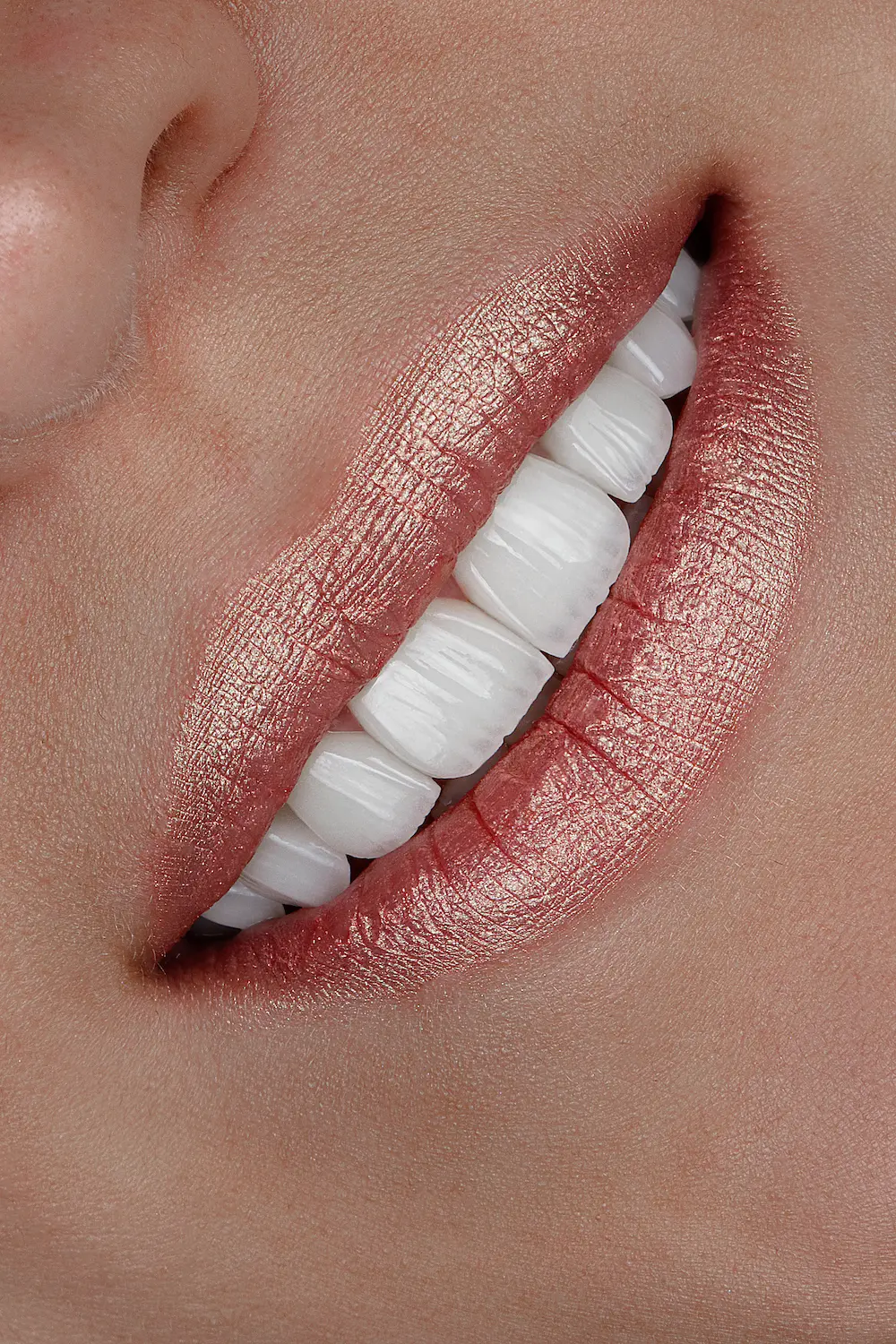 آیا زیر لمینت، دندان ها پوسیده می شوند؟ بررسی علل و راه های پیشگیری